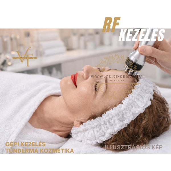 Bipoláris tripoláris hexapoláris rádiófrekvencia
